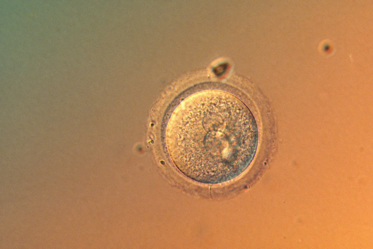 Lần đầu chỉnh sửa chính xác gene phôi người