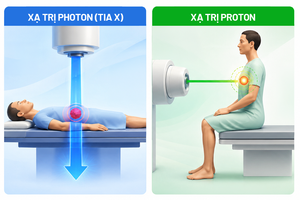 So sánh giữa xạ trị Proton và tia X truyền thống. Ảnh: Tâm Anh