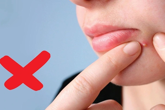 Nhiều chị em ở TPHCM bị nhiễm trùng, mặt sưng nề biến dạng vì tự nặn mụn