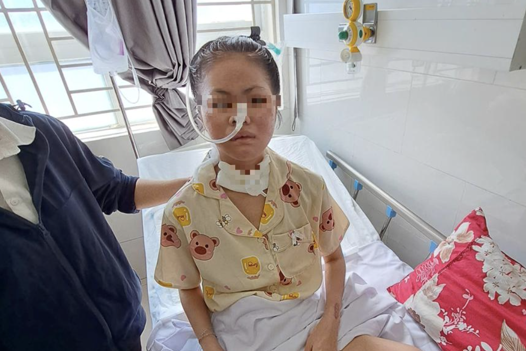 Hơn 60 ngày cứu cô gái ở TPHCM mắc căn bệnh "tự mình tấn công mình"