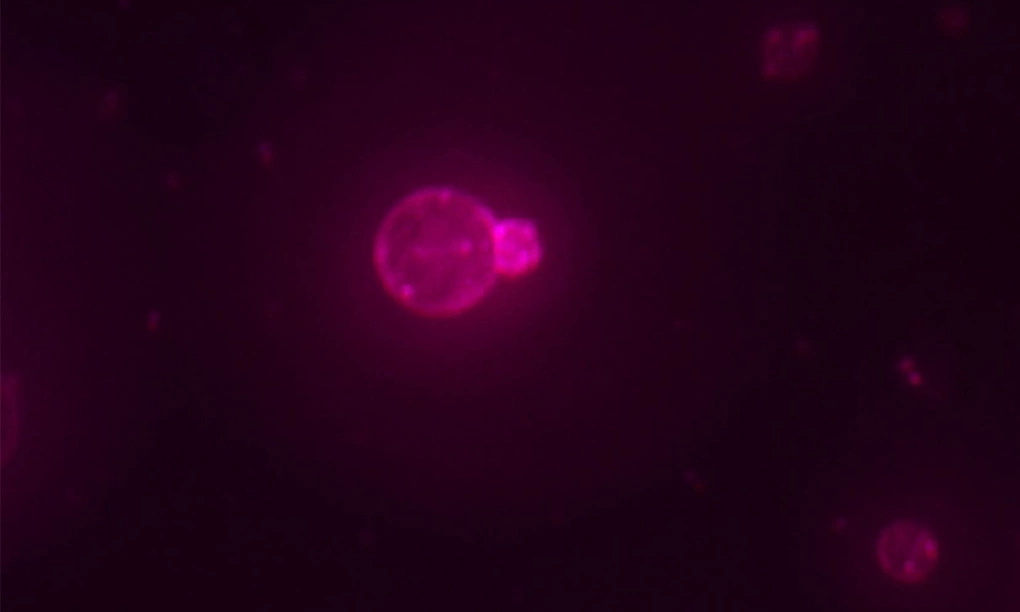 SpudCell dưới kính hiển vi. Ảnh: Adamala Lab